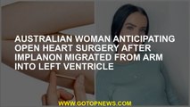 Australian woman anticipating open heart surgery after Implanon migrated from arm into left ventricl