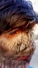 A doença rara que transforma um jovem em lobisomem