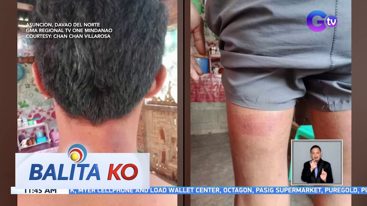 19-anyos na lalaki, binugbog umano ng pulis | BK