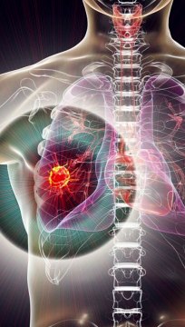 ब्रेस्ट कैंसर के शुरुवाती लक्षण क्या है ? Women Breast में दिखें ये बदलाव तो Cancer का खतरा है