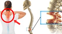 रीढ़ की हड्डी में गैप क्यों होता है | Spinal Cord Gap Symptoms in Hindi | Rid Ki Haddi Me Gap Hona