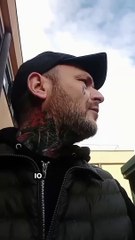 YARI DALL’ARA SCLERA IN OSPEDALE