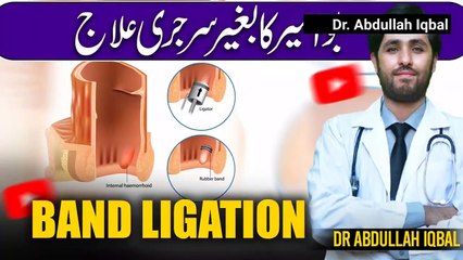 Get Rid Of Piles Without Surgery in 24 hours _ Band Ligation  _ Bawseer Ka Fori Ilaj