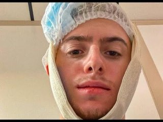 YouTube : Michou se dévoile avec des bandages sur le crâne après avoir été agressé par "6 mecs"