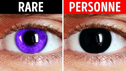 Pourquoi Ne Pouvez-Vous Pas Avoir Les Yeux Noirs Et D'autres Faits Sur Le Corps