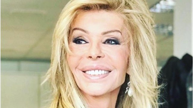 Bibiana Fernández se autorregala por su 65 cumpleaños varios retoques estéticos