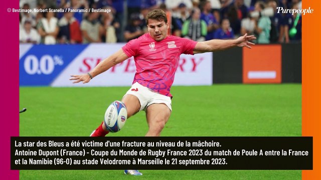 Antoine Dupont, impressionnant coquard : dans l'attente , la star du XV de France dévoile des clichés choc