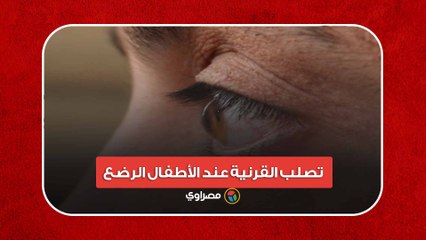 الأعراض والعلاج.. مرض تصلب القرنية عند الأطفال الرضع