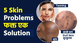 काळे डाग, वांग, tanning, सुरकुत्या, Dry Skin सगळ्या Problems वर एक Solution | Face Pack For Skin MA2
