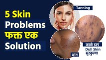 काळे डाग, वांग, tanning, सुरकुत्या, Dry Skin सगळ्या Problems वर एक Solution | Face Pack For Skin MA2