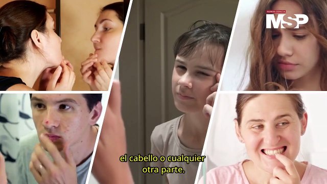 ¿Qué es la dismorfia corporal y cómo afecta? - #ExclusivoMSP