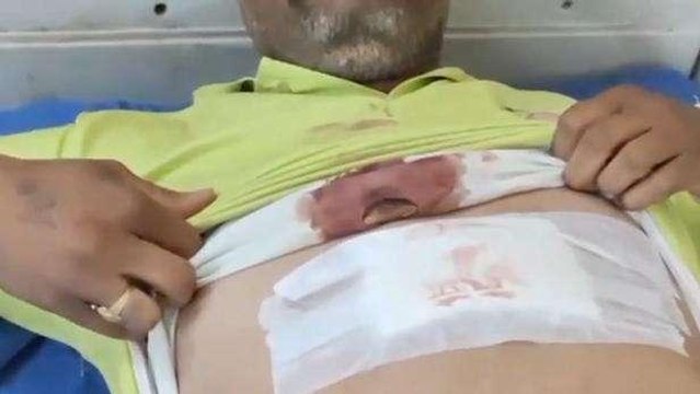 कोटा: घर में घुसकर युवक पर जानलेवा हमला, तलवारों व चाकू से हमला कर किया घायल