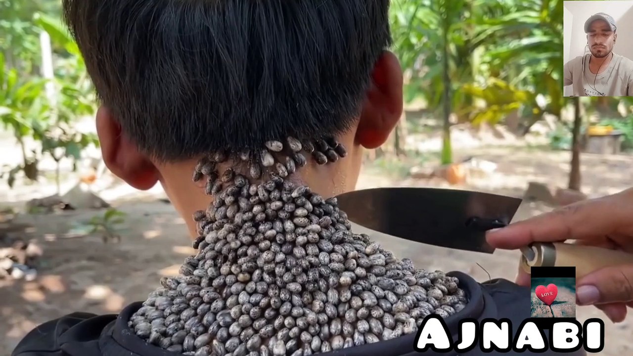 Remove lice sad boy