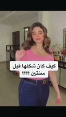 ليالي دهراب قبل وبعد التجميل: شاهد التغيرات المذهلة ✨