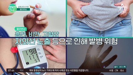 시력이 점점 떨어지는 황반변성! 예방하는 방법은? #황반변성