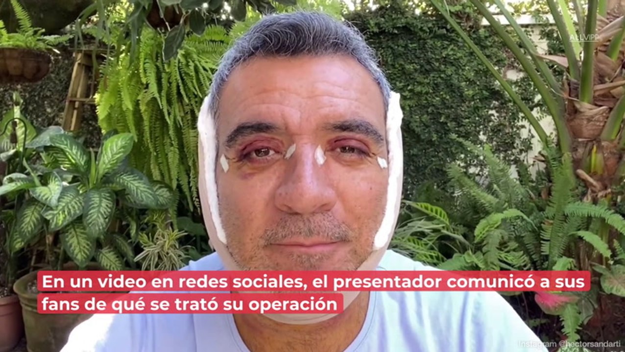Héctor Sandarti reaparece tras cirugía de reducción de papada