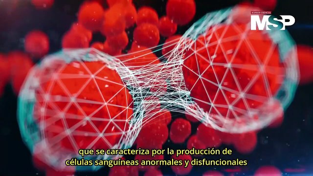 Leucemia: ¿Qué es y cuáles son sus tipos? - #ExclusivoMSP