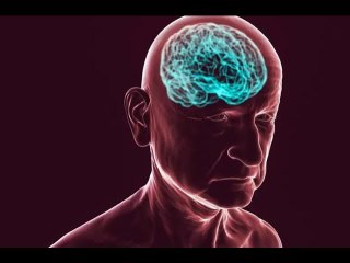 FDA Approves Promising New Alzheimer’s Drug Leqembi