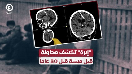 إبرة تكشف محاولة قتل مسنة قبل 80 عاماً