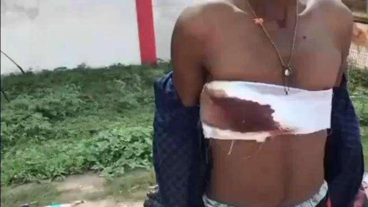 सिंगरौली: धारदार हथियार से किया जानलेवा हमला,आर्केस्टा बना विवाद की वजह