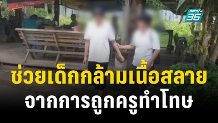 เร่งช่วยเหลือเด็กถูกครูทำโทษลุกนั่ง จนกล้ามเนื้อสลาย | เข้มข่าวค่ำ | 7 ต.ค. 66