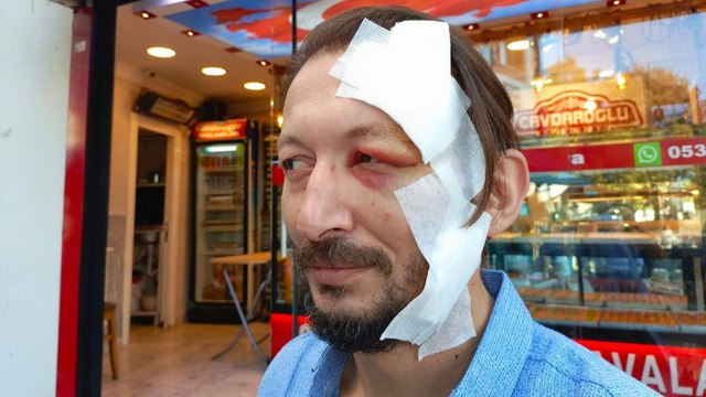 Esenler'de esnafa 'ne bakıyorsun' diyerek bıçakla saldırdı