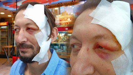 Esnafa 'ne bakıyorsun' diyerek bıçakla saldırdı 