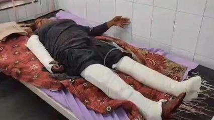 अलवर: जमीन विवाद बना जानलेवा, विधवा मां और बेटे के कुल्हाड़ी से काटे हाथ पैर, देखें VIDEO