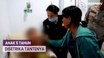 Habiskan Nasi dan Rambutan, Anak 5 Tahun Disetrika Tantenya