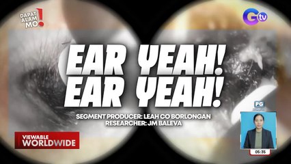 Ear canal, puwede nang makita habang nililinisan? | Dapat Alam Mo!