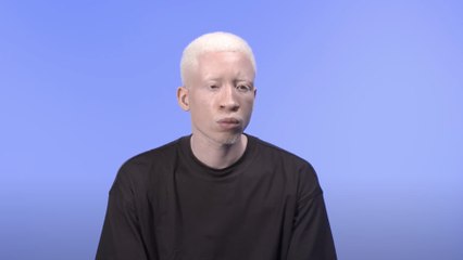 Charles Edouard, albinos : "Je ne me trouvais pas beau, j’avais honte de moi"