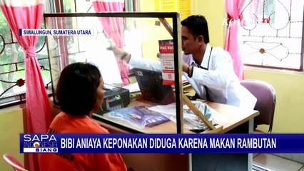 Tega, Seorang Bibi di Kabupaten Simalungun Setrika Keponakan hingga Alami Luka Bakar 30 Persen