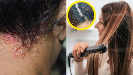 इन लोगों को नहीं करना चाहिए हेयर स्ट्रेटनिंग | Hair Straightening Kise Nahi karni Chahiye | Boldsky
