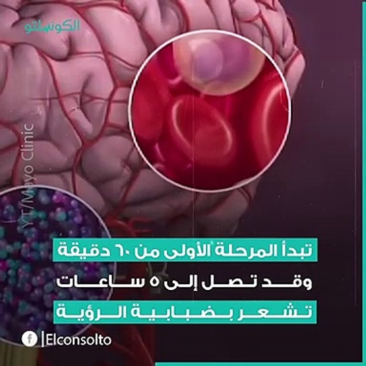 كيف يسيطر الصداع النصفي المزمن على رأسك؟