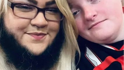 Après s'être rasée toute sa vie, elle décide d'assumer sa pilosité faciale