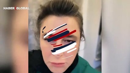 Esra Dermancıoğlu sosyal medyadan hastalığını açıkladı