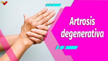 Buena Vibra | Artrosis, trastorno degenerativo de las articulaciones