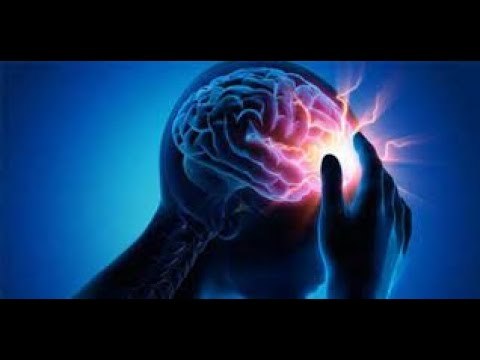 Journée mondiale de l'AVC : 10 choses à savoir sur l'accident vasculaire cérébral