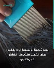 قمل الرأس الطرق الفعالة للتخلص منه نهائيا