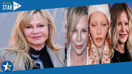 Kim Basinger, Madonna, Meg Ryan, Donatella Versace… Ces stars métamorphosées après la chirurgie