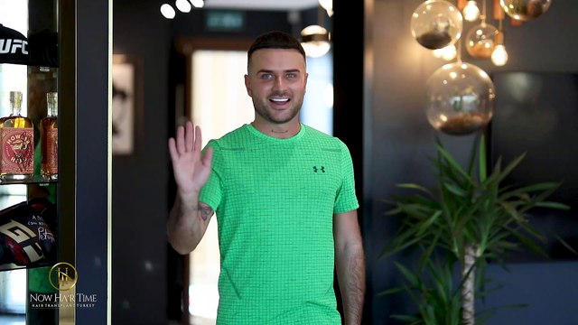 Final Result Of The Hair Transplant After 7 Months!