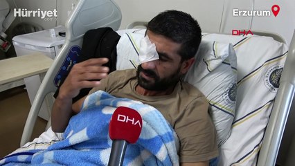 Hasımları av tüfeğiyle vurdu: Bir gözünü kaybetti, vücudunda 32 saçmayla yaşıyor