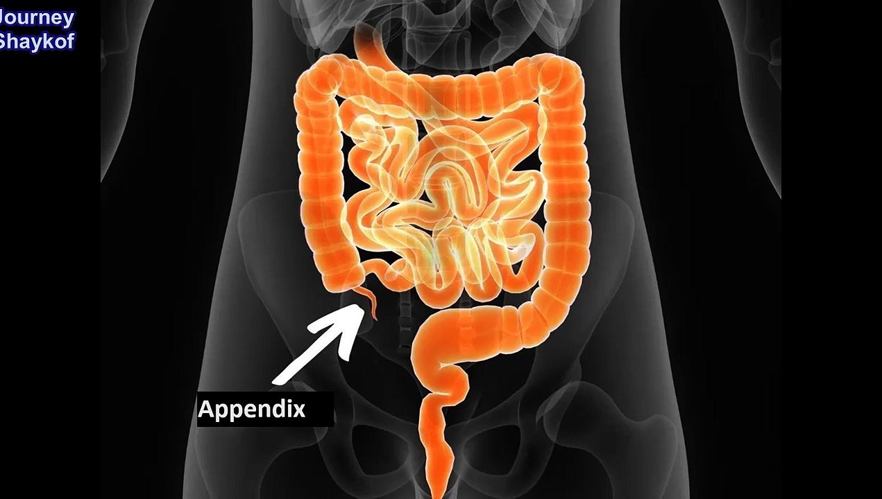 Why do I need an appendix