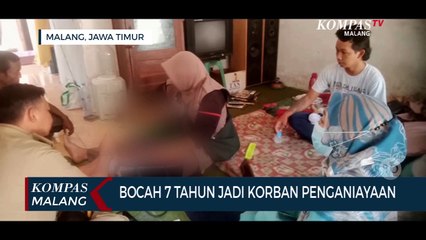 Bocah 7 Tahun Di Kota Malang Jadi Korban Penganiayaan
