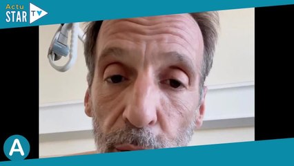 Mathieu Kassovitz dévoile des images de ses blessures, du titane dans le fémur, âmes sensible s'ab
