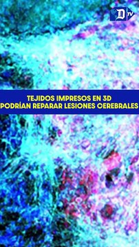 Tejidos impresos en 3D de células madre podrían reparar lesiones cerebrales | La buena noticia