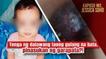 2-anyos na bata, nilagnat dahil raw pinasukan ng garapata sa tenga?! | Kapuso Mo, Jessica Soho