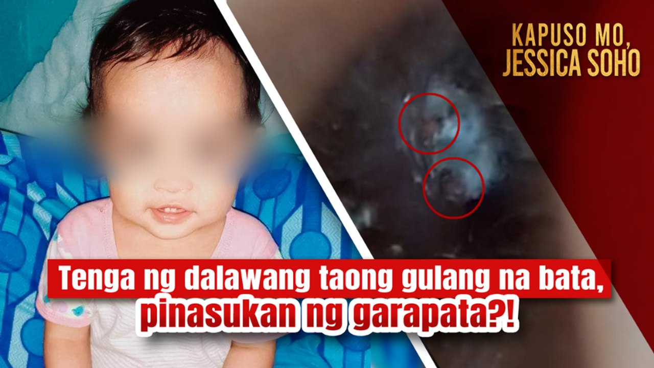 2-anyos na bata, nilagnat dahil raw pinasukan ng garapata sa tenga?! | Kapuso Mo, Jessica Soho