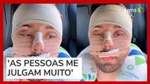 Rico Melquíades explica que fez cirurgia no rosto por 'não aguentar mais ser chamado de feio'