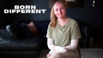 My Skin Tears Like Tissue Paper | BORN DIFFERENT